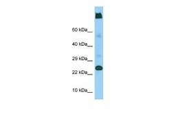 Ly-6G5C Rabbit anti-Human, Polyclonal, Novus Biologicals 0.1ml; Unconjugated:Antibodies,